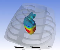 heart-induced vibrations measured non-invasively on the chest surface to monitor cardiovascular health